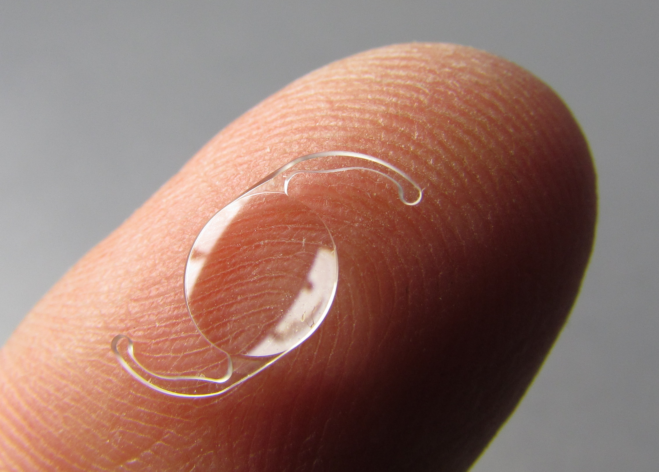 A clear foldable intraocular lens implant resting on a fingertip, showing how small a replacement lens is