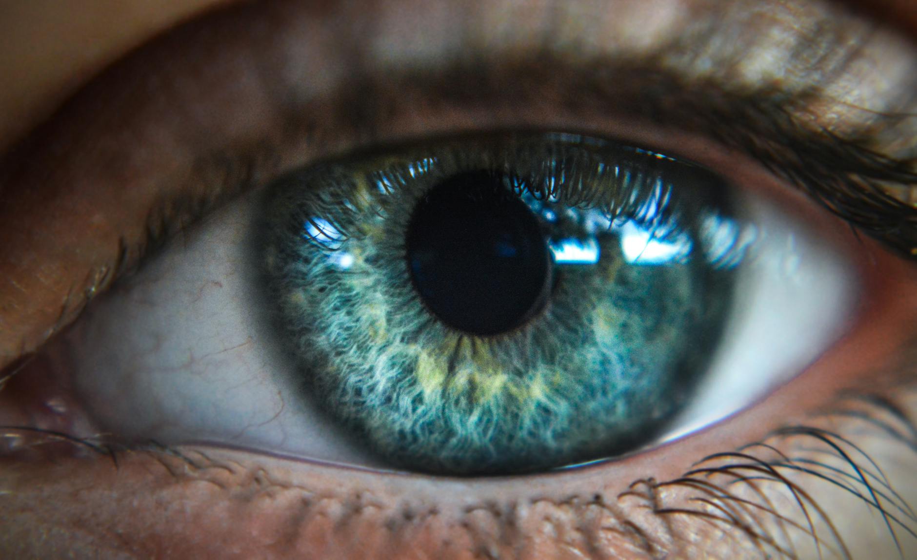 Optimising Dry Eyes Before Cataract Surgery or LASIK: Why the Ocular Surface Matters