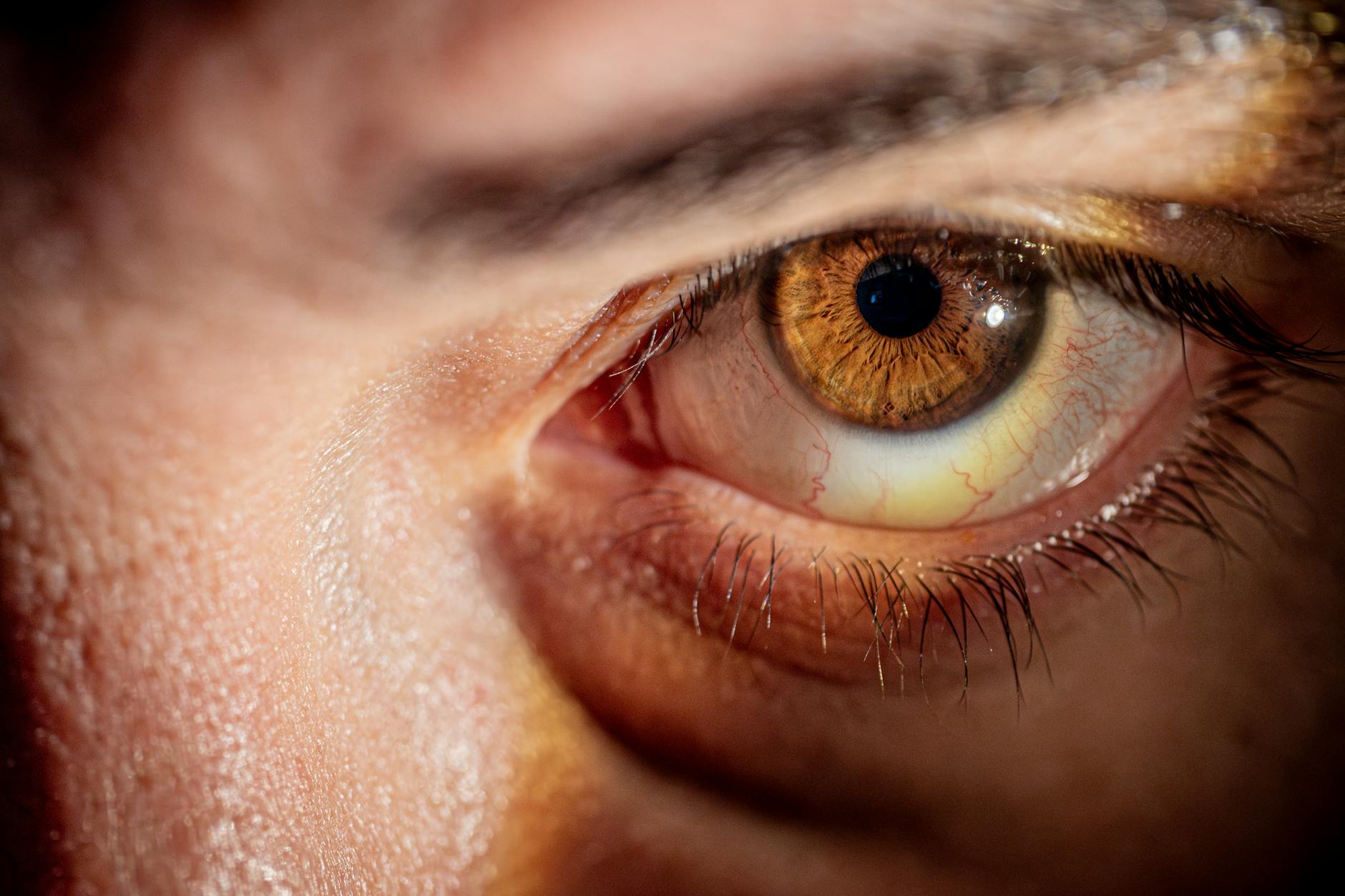 What Happens If Cataracts Are Left Untreated?
