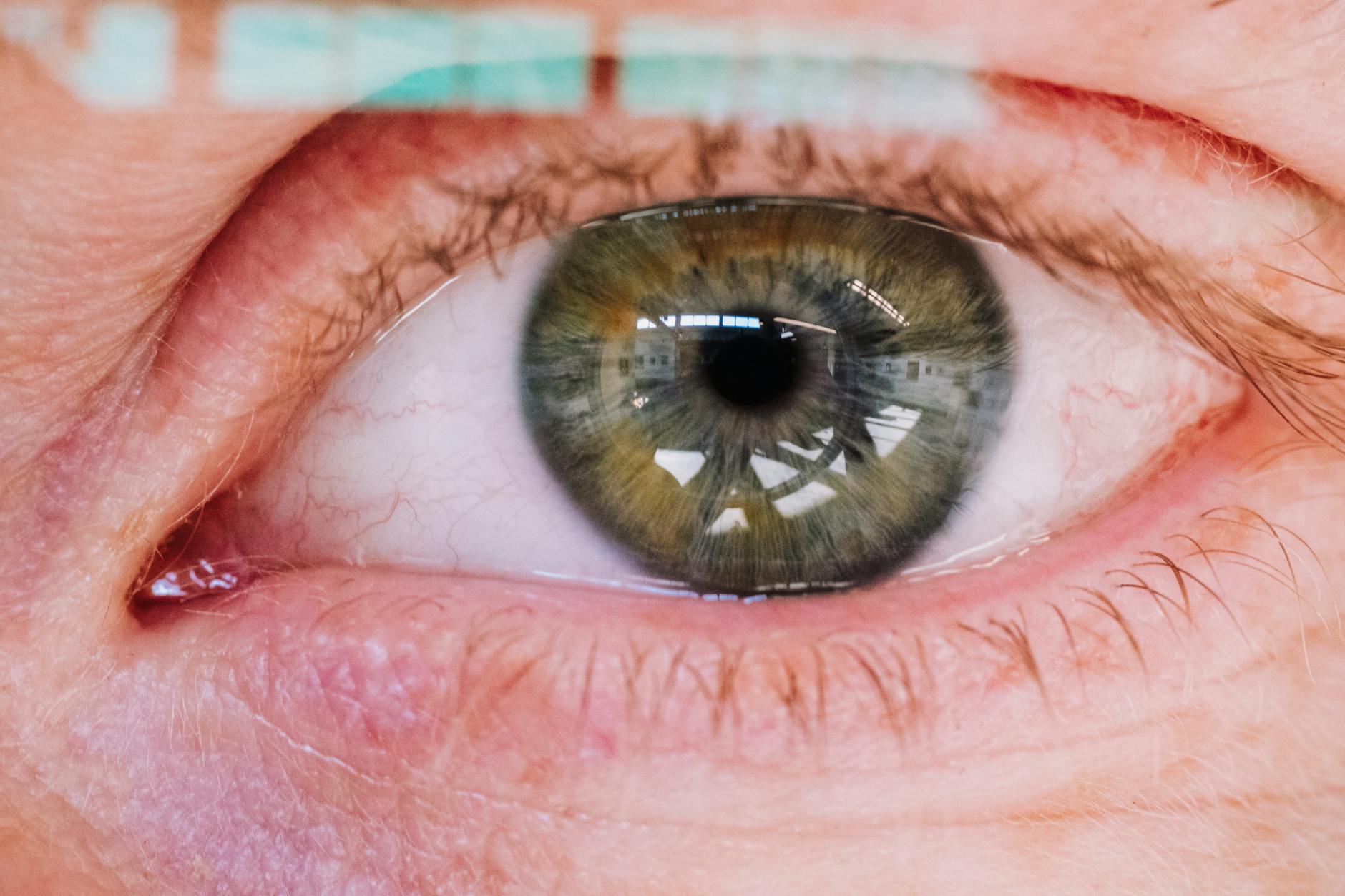 What Is Laser Eye Surgery and How Can It Transform Daily Life?