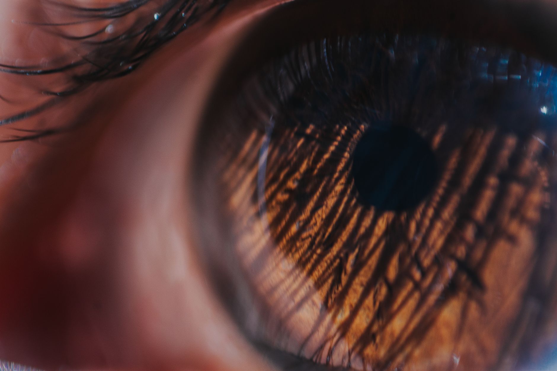 Cataract Surgery in Complex Eyes (Small Pupils, Pseudoexfoliation): How a Consultant Tailors Your Plan